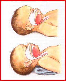 airway roll