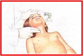 carotid diagram