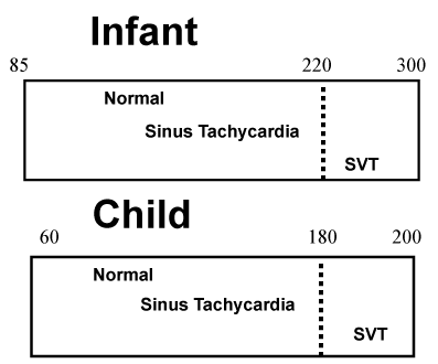 Heart Rates in Children diagram