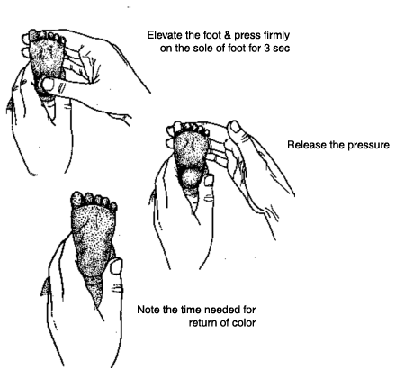 capillary refill