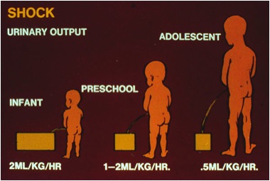 Urine Output diagram